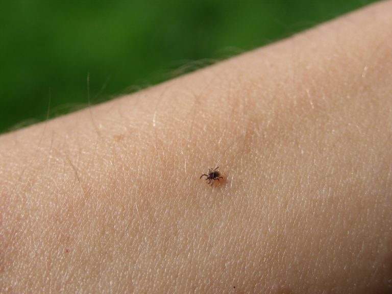 Kullancs élősködő egy ember karján